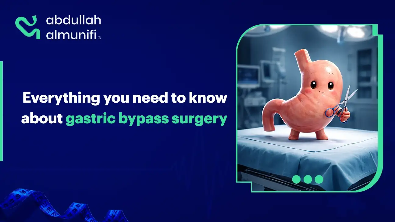 Gastric sleeve surgery procedure showing reduction of stomach size using laparoscopic technique