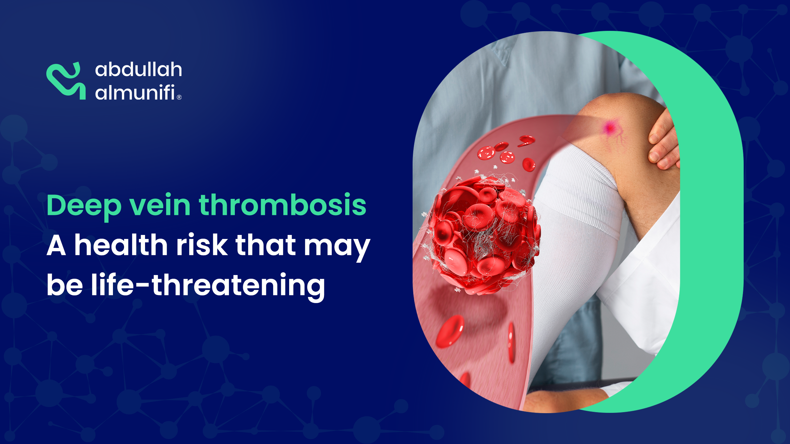 Deep Vein Thrombosis