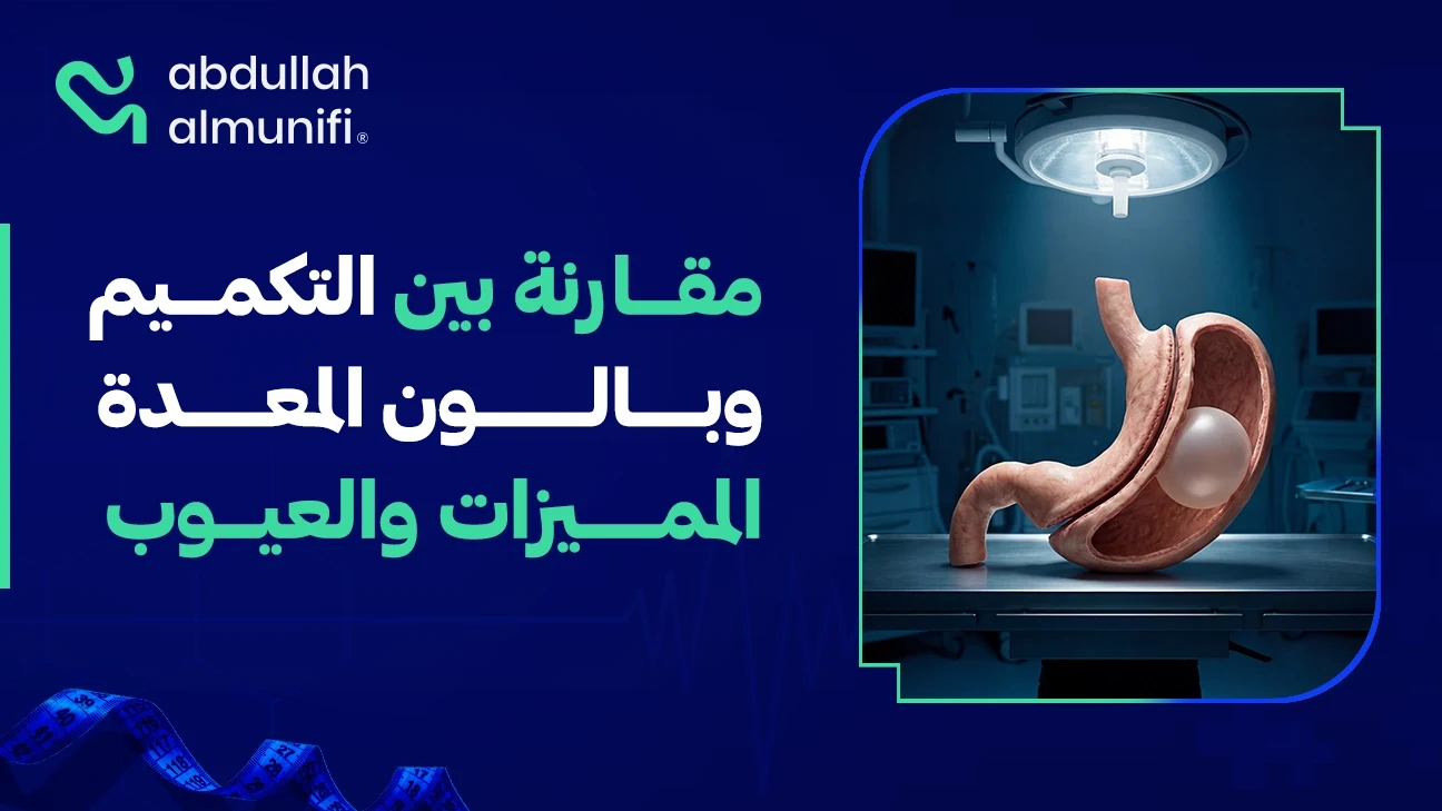 مقارنة بين عملية تكميم المعدة وبالون المعدة لإنقاص الوزن