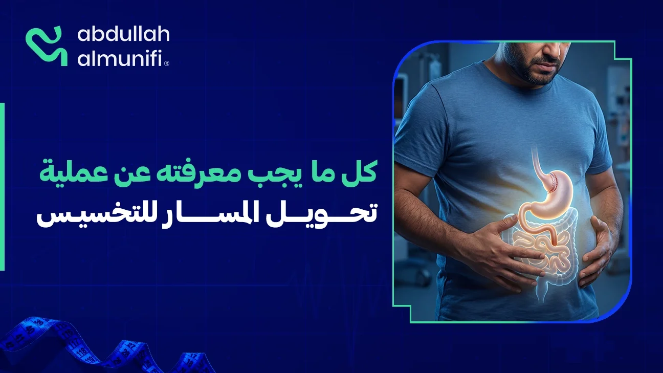 رسم توضيحي لعملية تحويل مسار المعدة يوضح تصغير المعدة وتغيير مسار الهضم