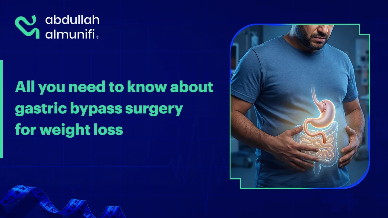 Illustration of gastric bypass surgery showing stomach reduction and digestive rerouting