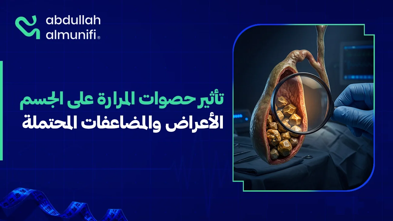 حصوات المرارة داخل المرارة تسبب ألم ومشاكل في الهضم