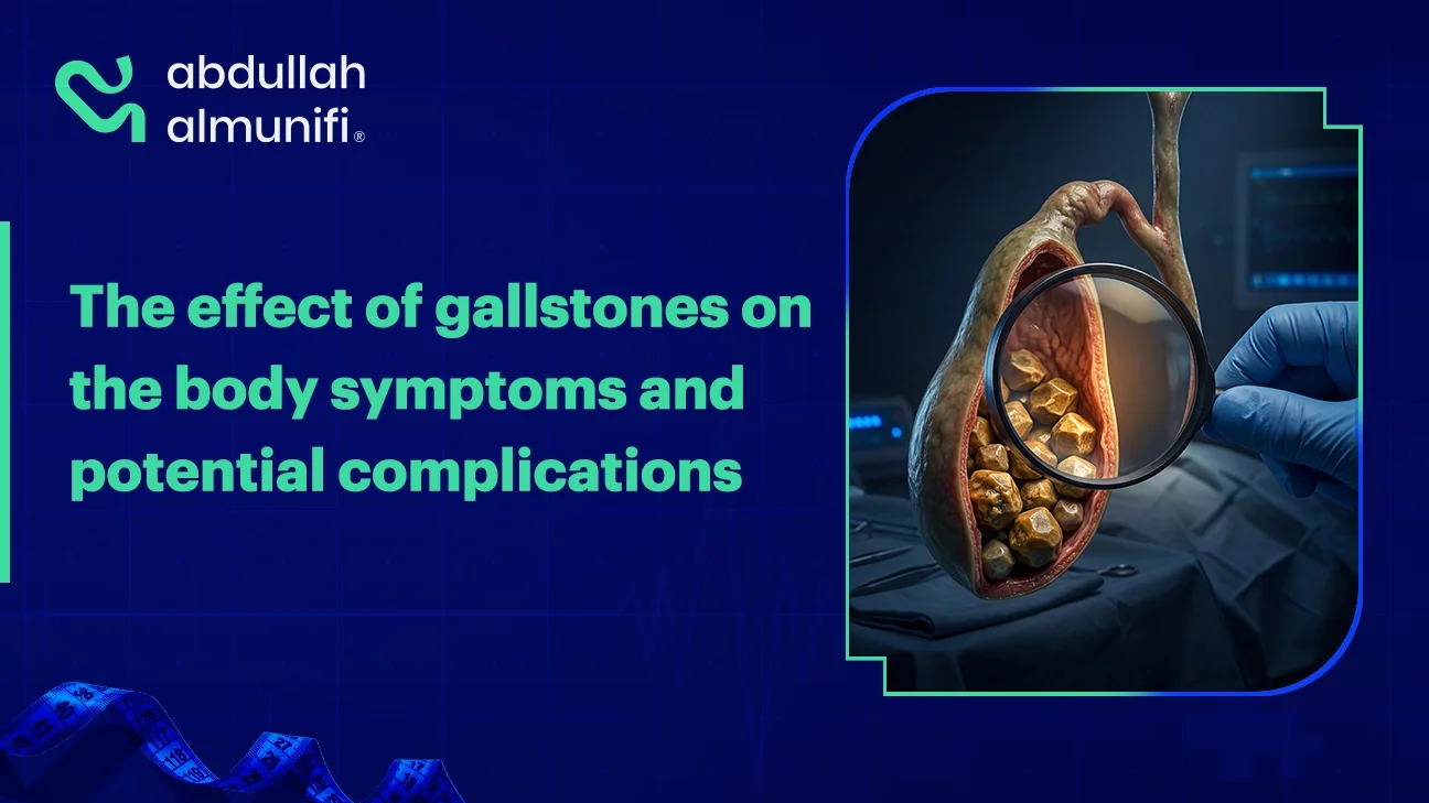 Gallstones in the gallbladder causing pain and digestive complications