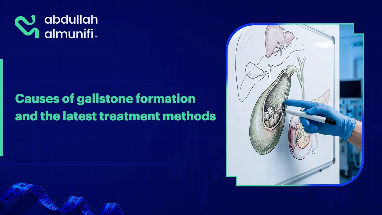Gallstones formation in the gallbladder with illustration of causes and treatment