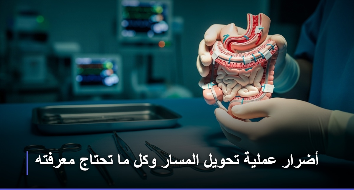 أضرار عملية تحويل المسار وكل ما تحتاج معرفته